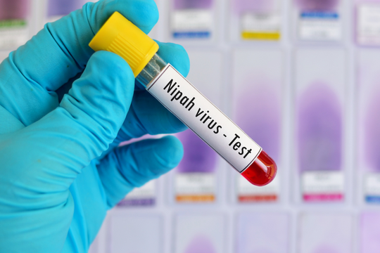 Không chủ quan với virus mới